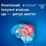 Яка медична допомога гарантована внутрішньо переміщеним особам при інсульті